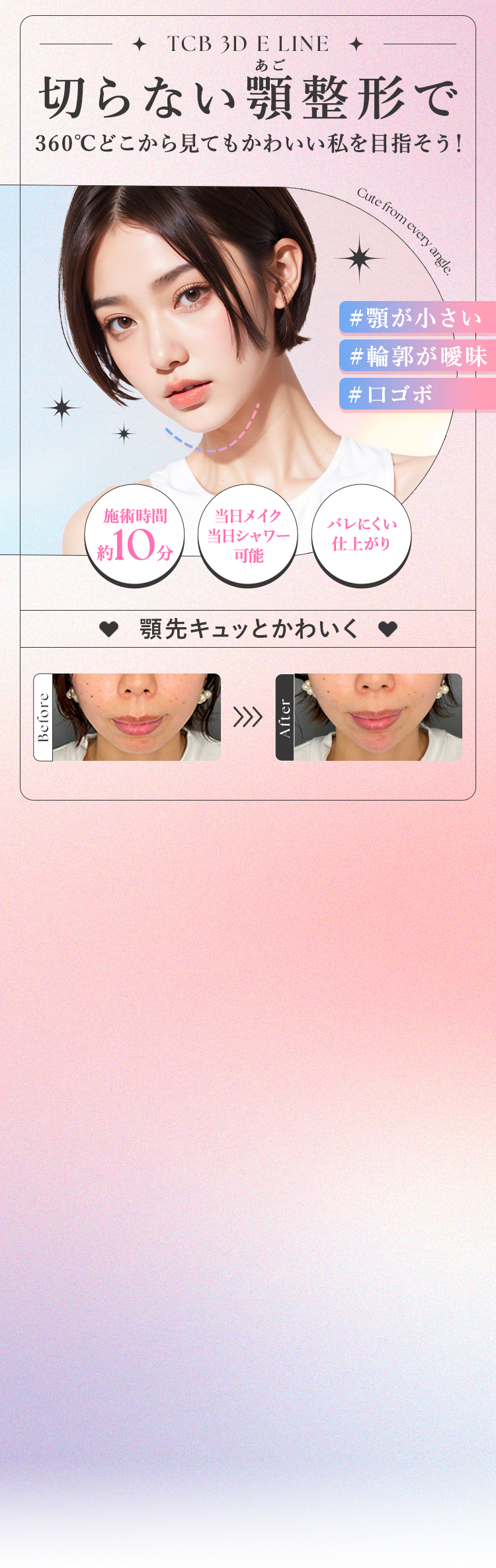 切らない顎整形で360度どこから見てもかわいいワタシ♥