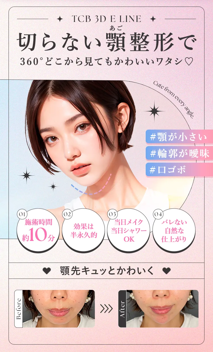 切らない顎整形で360度どこから見てもかわいいワタシ♥
