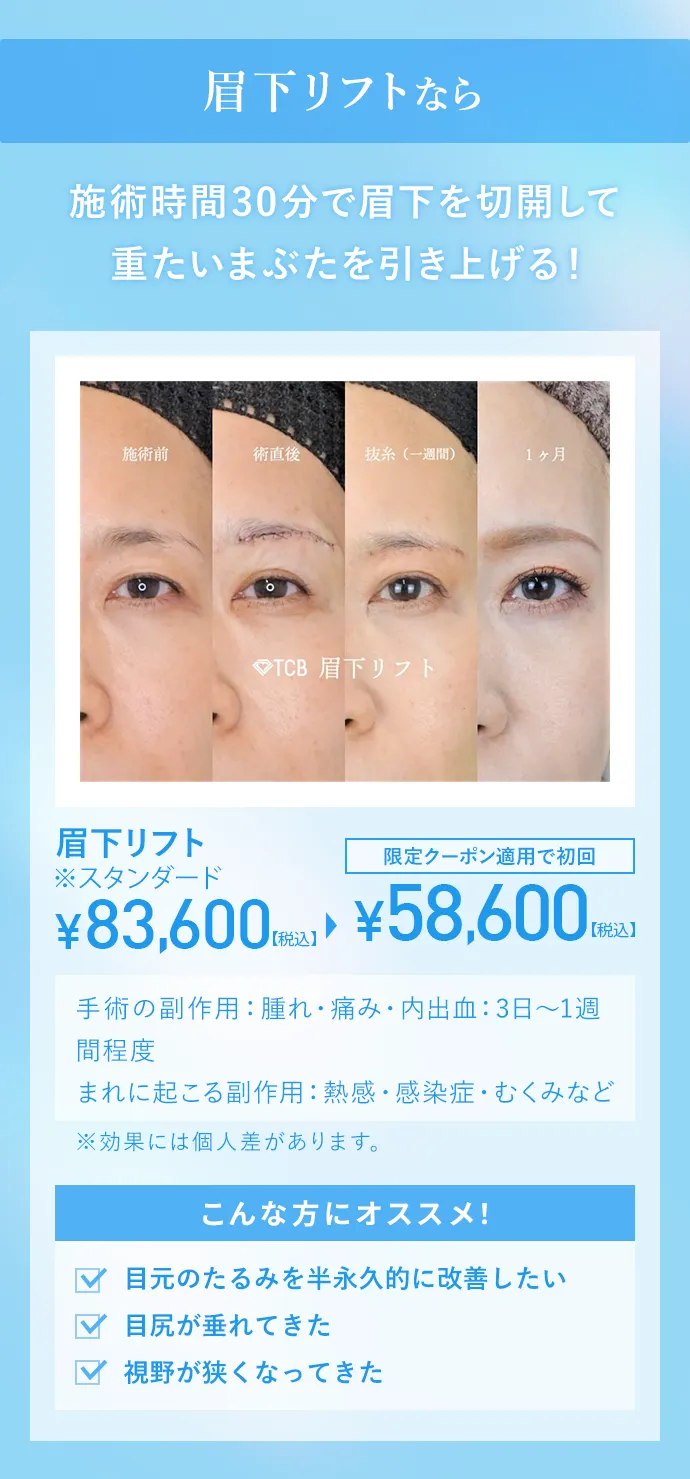 眉下リフトなら施術時間30分で眉下を切開して重たいまぶたを引き上げる！