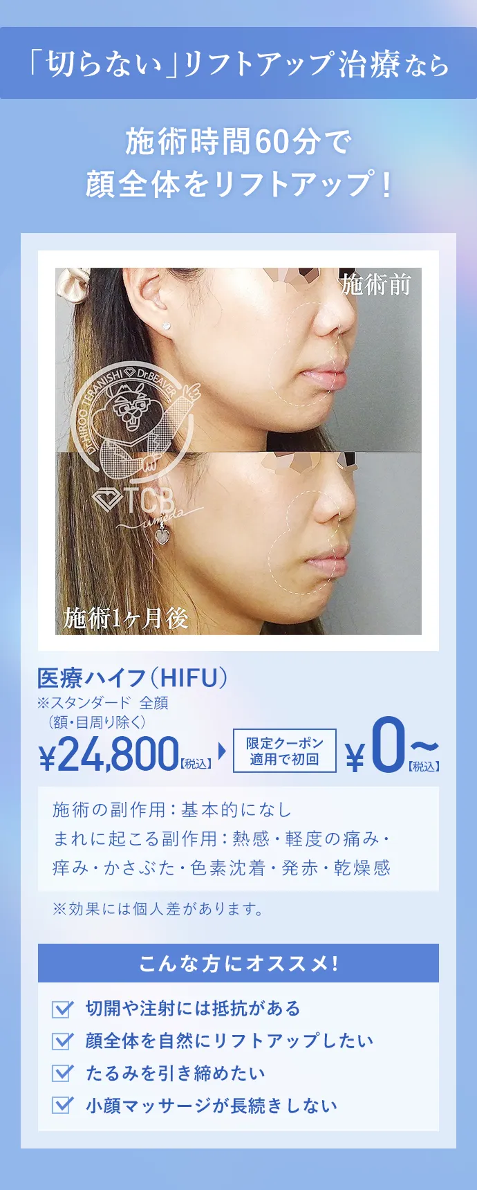 「切らない」リフトアップ治療なら施術時間60分で顔全体をリフトアップ！
