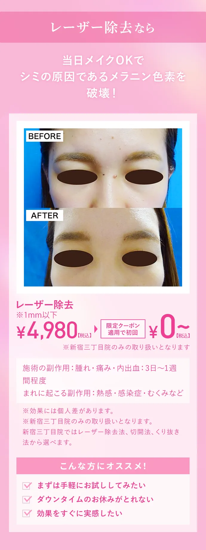 レーザー除去なら当日メイクOKでシミの原因であるメラニン色素を破壊！