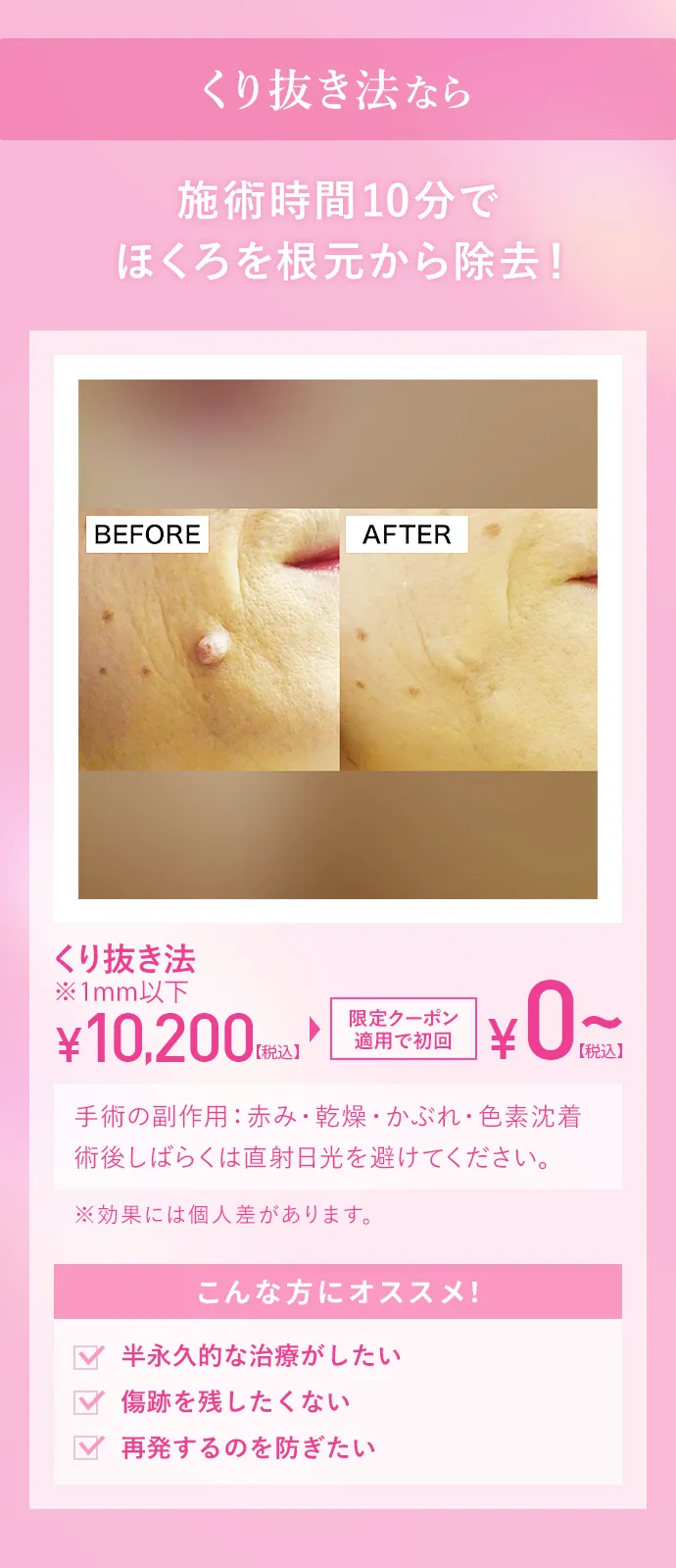くり抜き法なら施術時間10分でほくろを根本から除去！