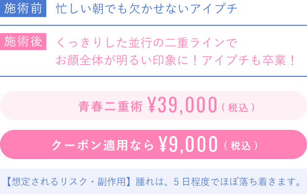 青春二重術39000円
