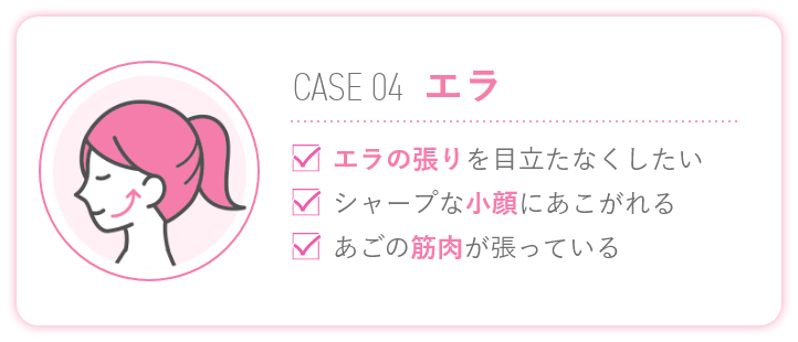 エラ張り改善