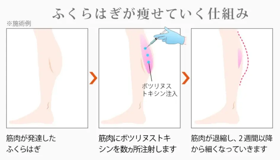 ふくらはぎが痩せていく仕組み