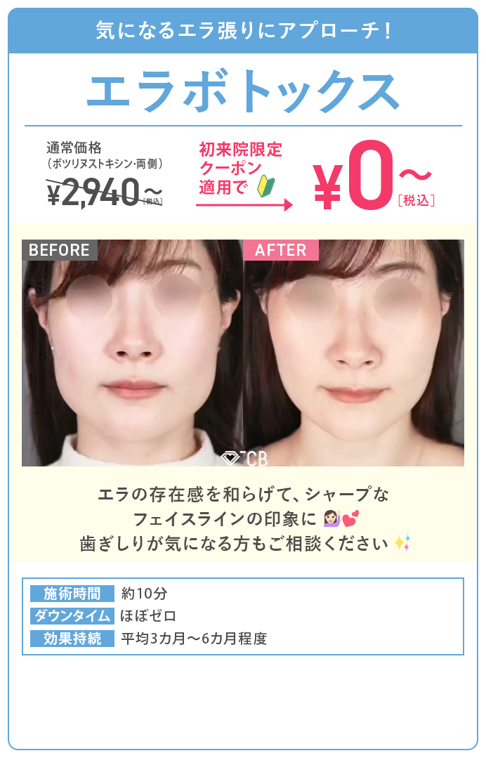 エラボトックス