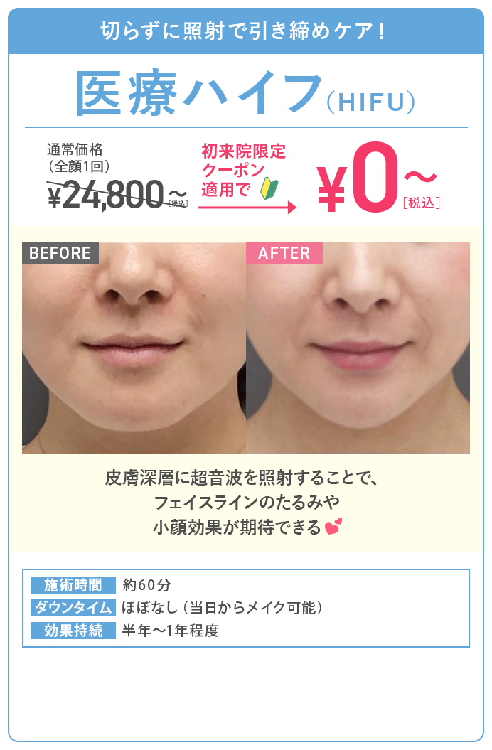 医療ハイフ（HIFU）
