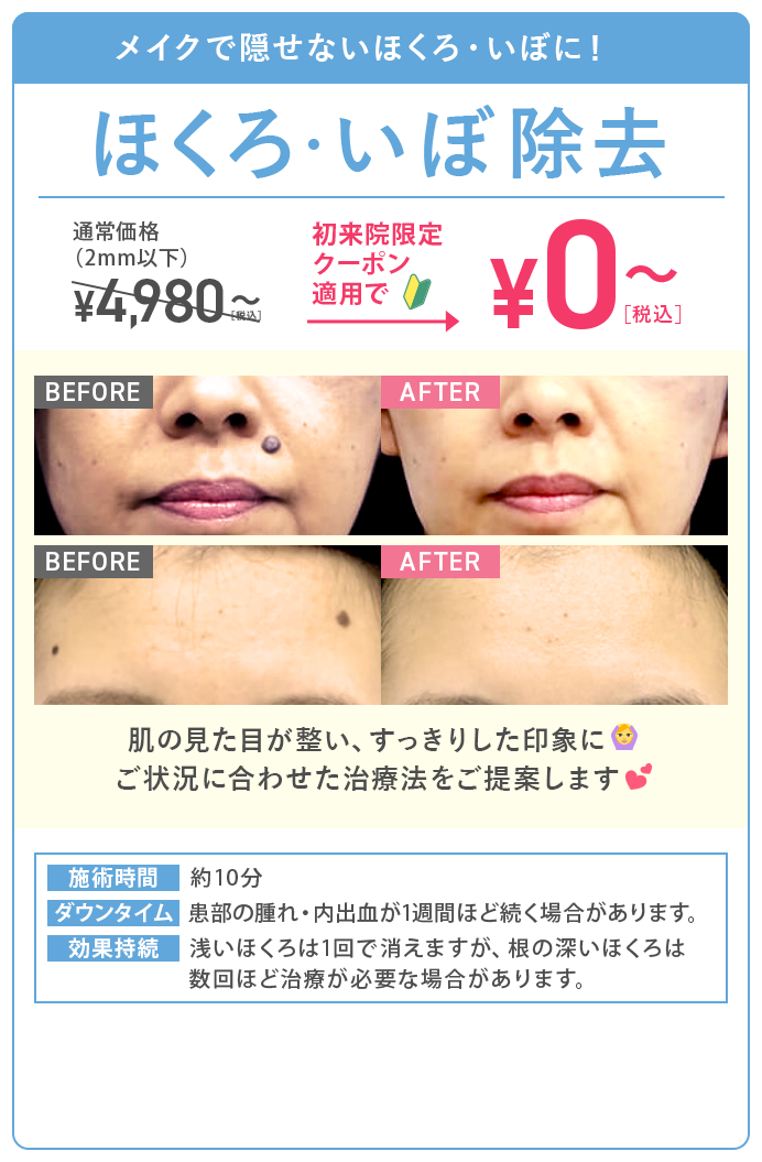ほくろ・いぼ