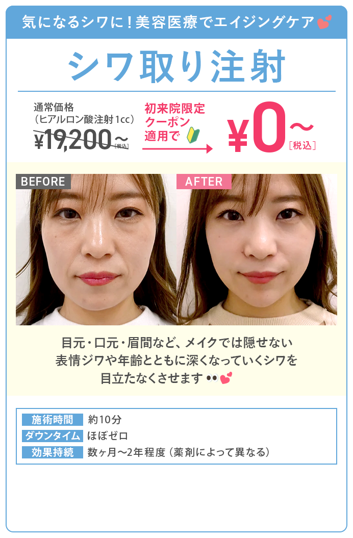 シワ取り注射