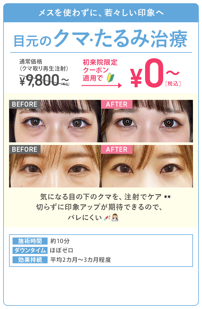 目元のクマ・たるみ治療