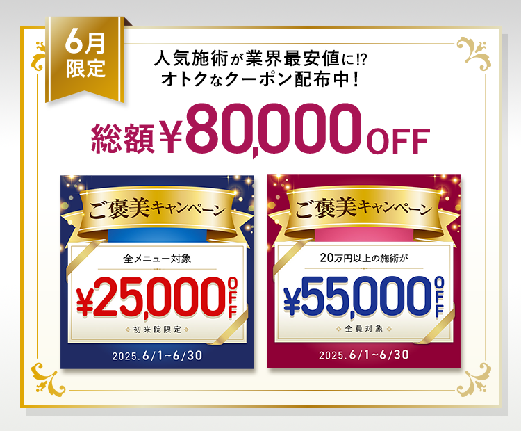 最大80,000円OFF