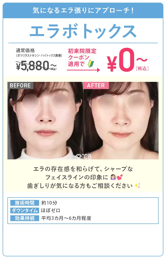 エラボトックス