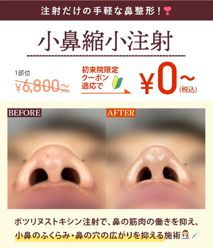 小鼻縮小注射