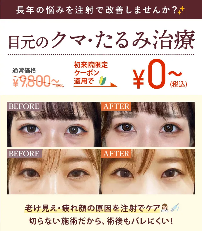 目元のクマ・たるみ治療