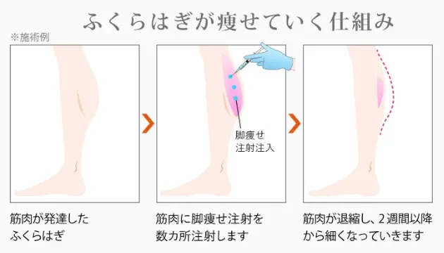 ふくらはぎが痩せていく仕組み