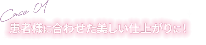 Case 01 患者様に合わせた美しい仕上がりに！