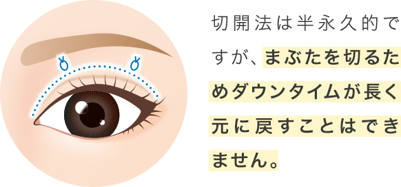 切開法は半永久的ですが、まぶたを切るためダウンタイムが長く元に戻すことはできません。