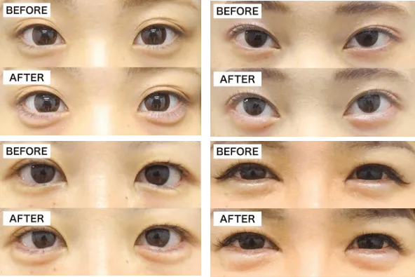 実際の症例写真！