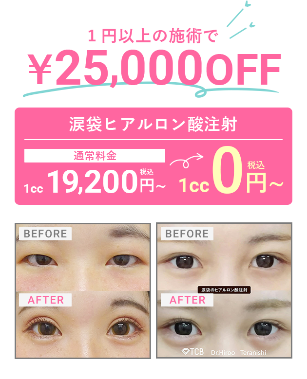 1円以上の施術で¥25,000円OFF