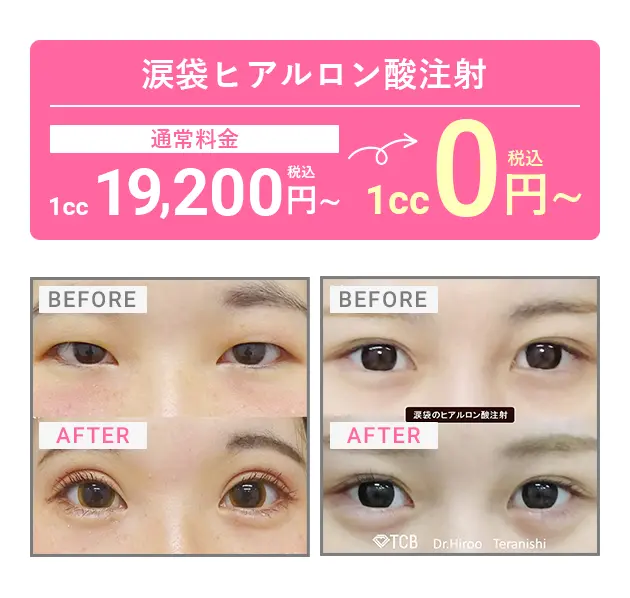 1円以上の施術で¥25,000円OFF