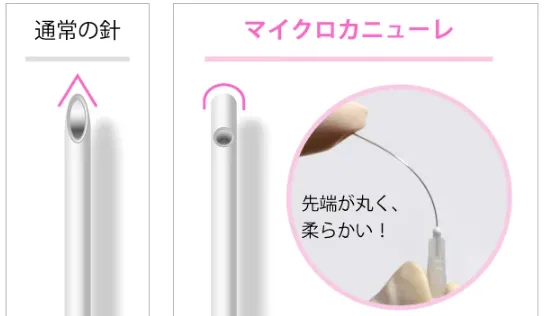 従来の針とマイクロカニューレ比較