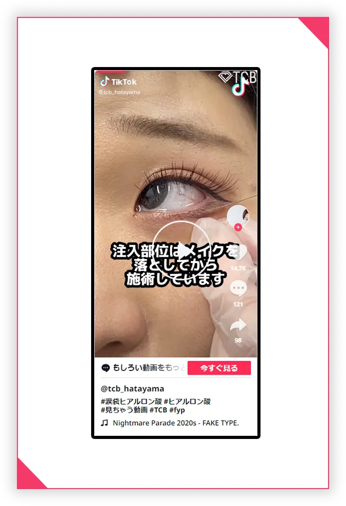 TikTok 施術中動画