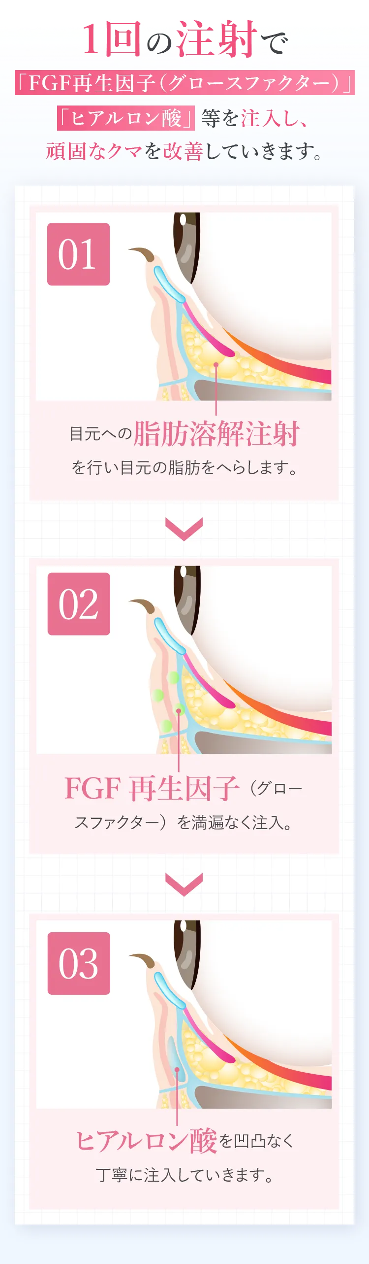 1回の注射で「FGF再生因子(グロースファクター)」、「ヒアルロン酸」等を注入し、頑固なクマを改善していきます。