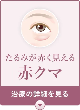 赤クマ