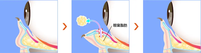 図解