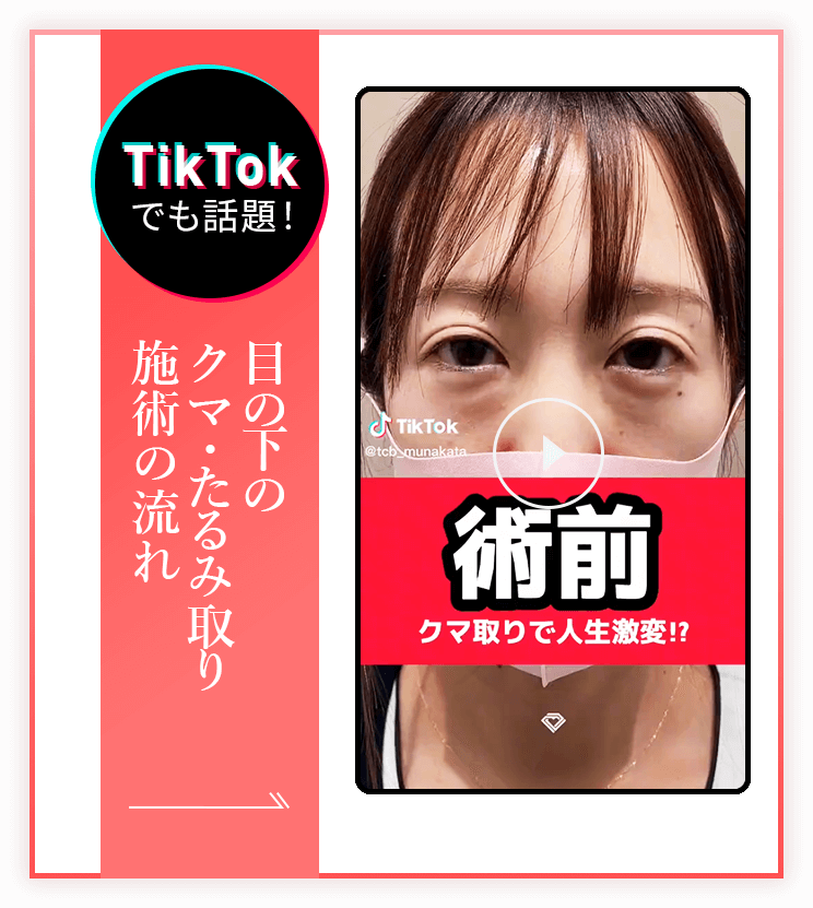 目の下のクマ・たるみ取り 施術中動画