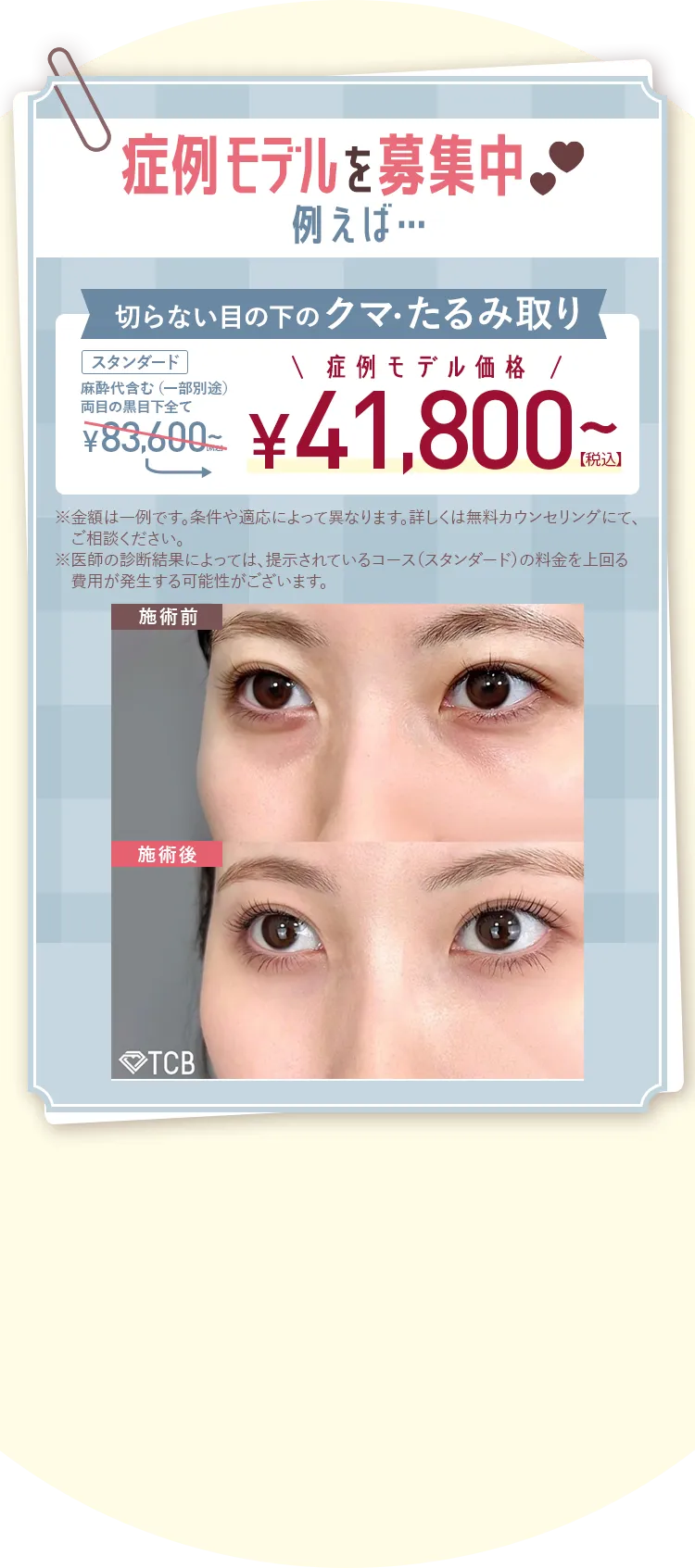 先着30名様限定 1番お得に受けられる!症例モデルを募集中