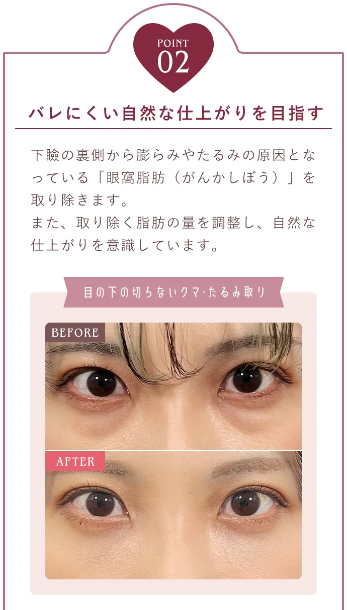 POINT02 バレにくい自然な仕上げりを目指す