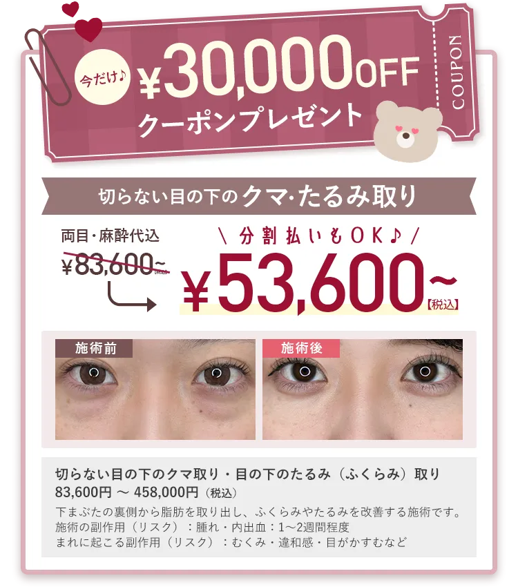 切らない目の下のクマ・たるみ取り 53,600円（税込）～