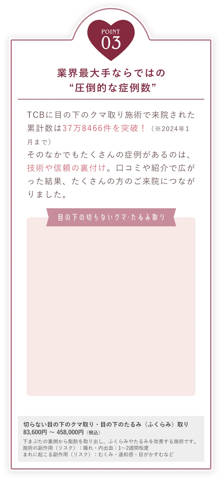 POINT03 業界最大手ならではの「圧倒的な症例数」