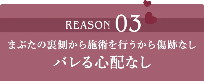 REASON03 まぶたの裏側から施術を行うから傷跡なし バレる心配なし