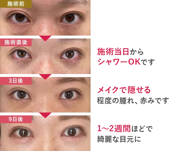 術後の経過の写真