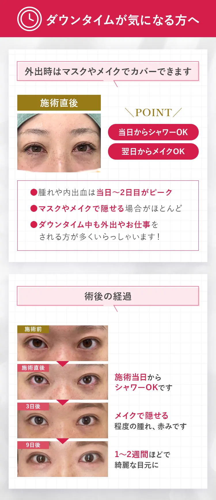 ダウンタイムが気になる方へ