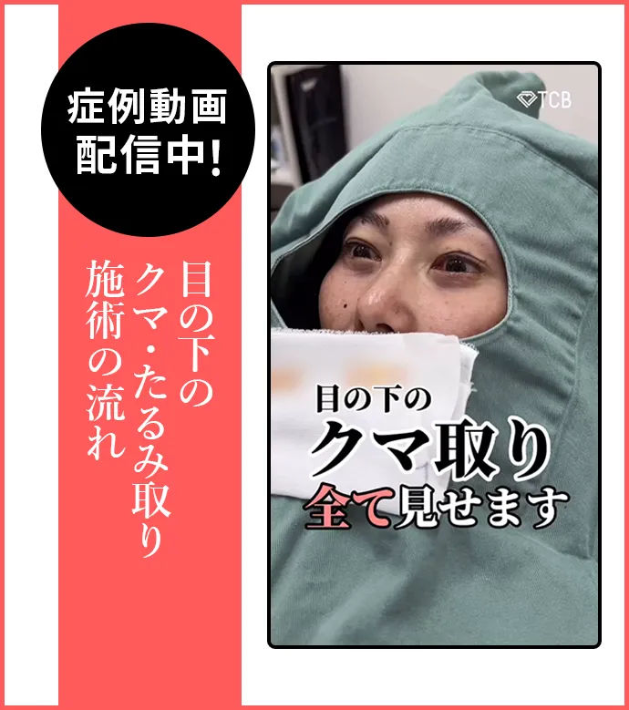 目の下のクマ・たるみ取り 施術中動画