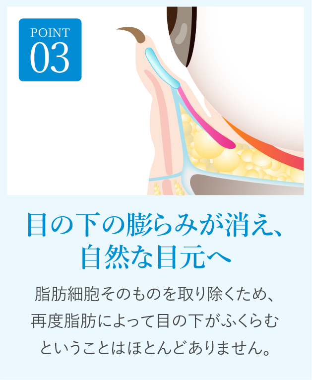 POINT03 1度で、半永久的な効果!