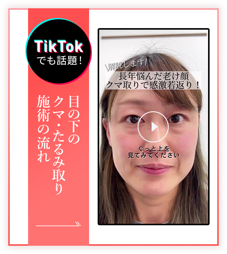 目の下のクマ・たるみ取り 施術中動画