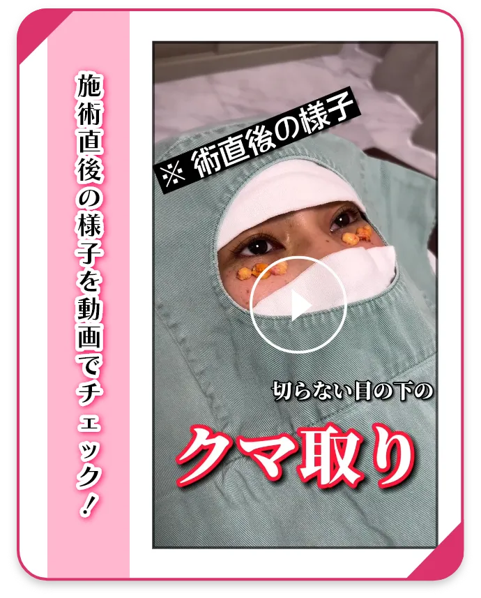 目の下のクマ・たるみ取り 施術中動画