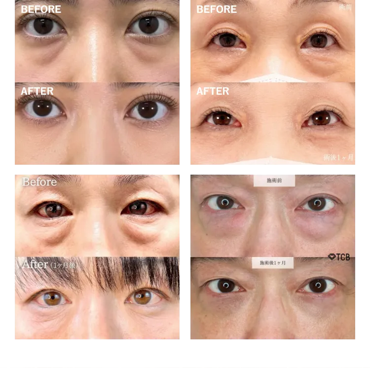 症例写真