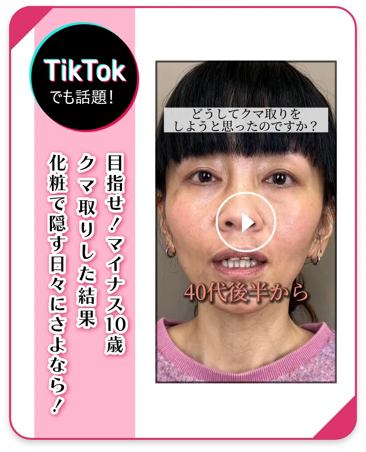 目の下のクマ・たるみ取り 施術中動画