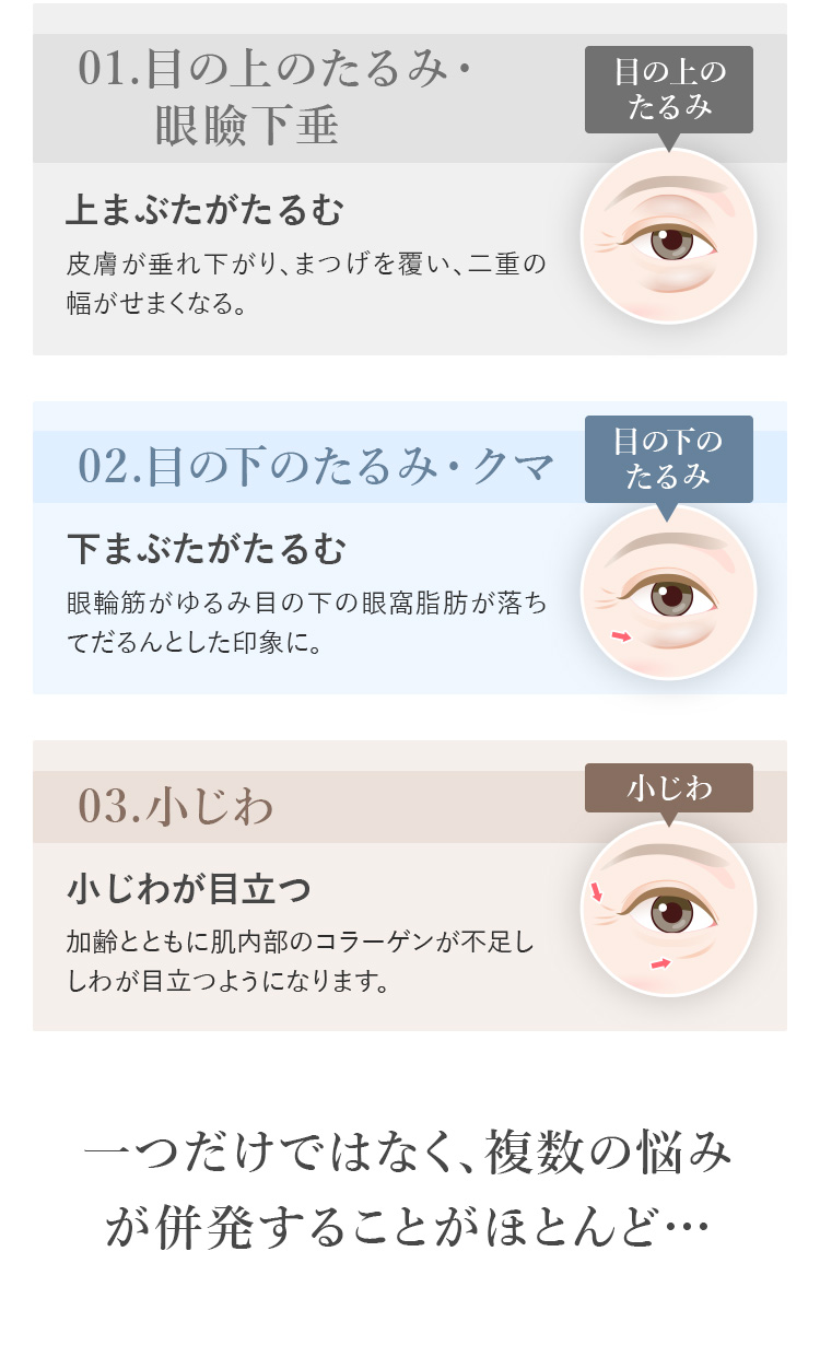 あなたを悩ませる目元の老け見え原因は・・・
