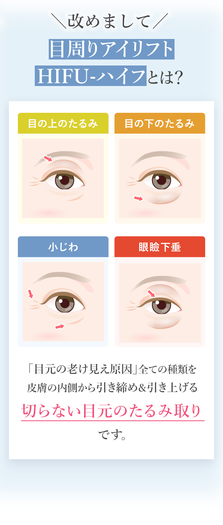 目周りアイリフト HIFU-ハイフとは？