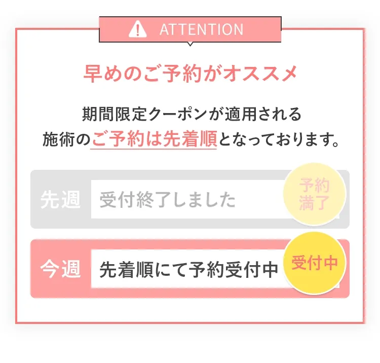 早めのご予約がオススメ