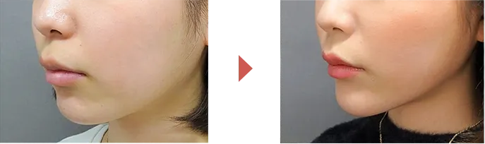 ビフォーアフター