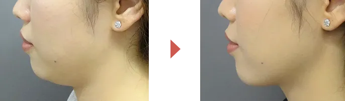 ビフォーアフター