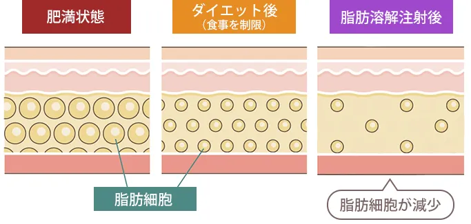 脂肪細胞