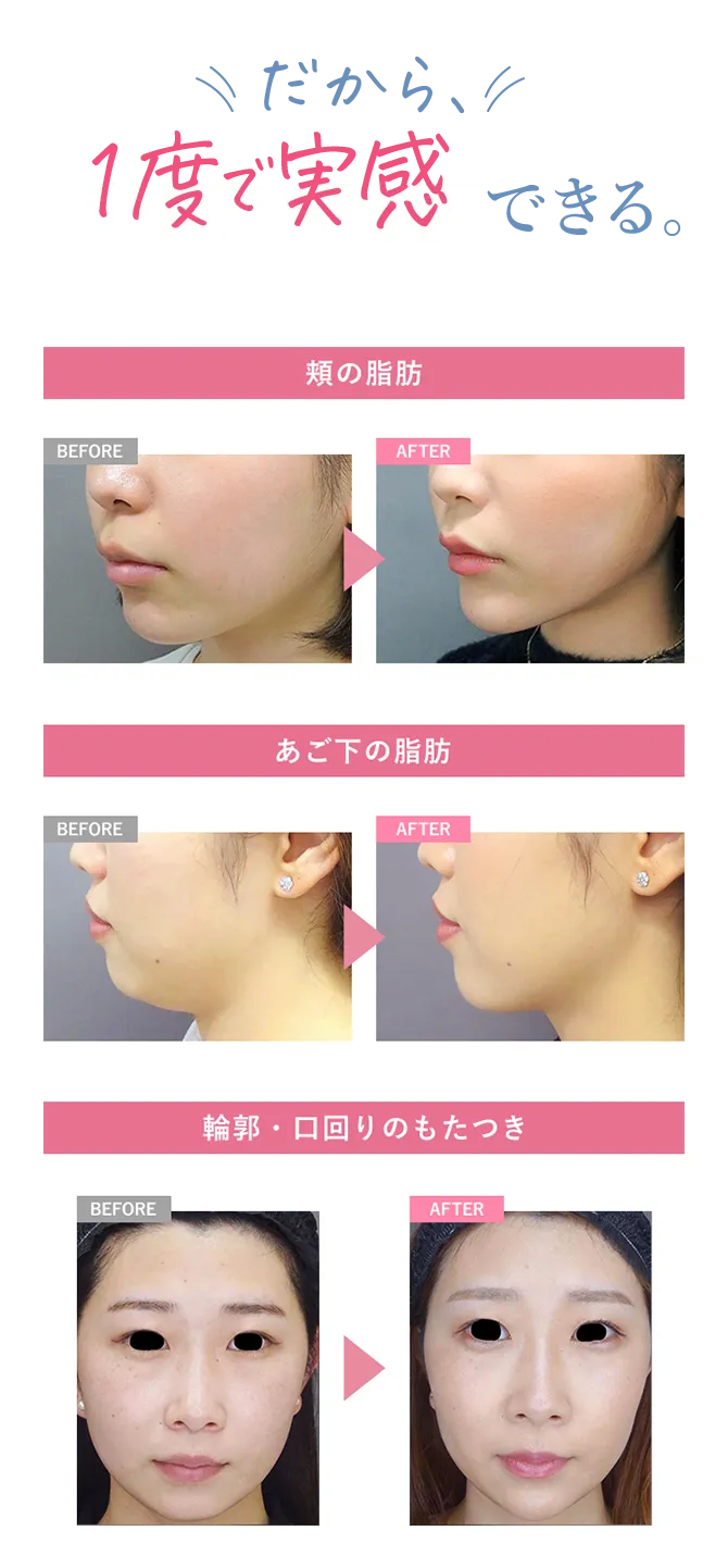 1度で実感できる